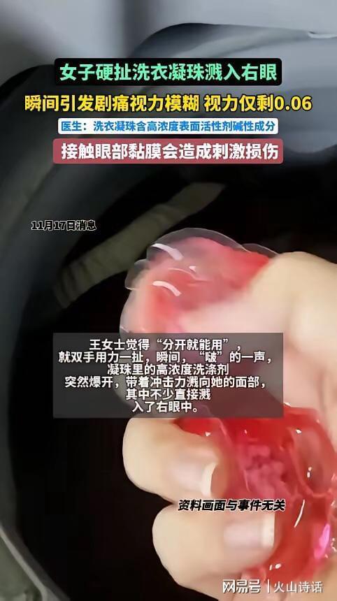 杭州一女子撕扯凝珠发生意外致眼睛失明pg电子试玩恐怖！洗衣引发“爆炸”(图2)